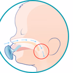 PhysioForma® Micro 
szilikon cumi 
0-2 hó thumbnail 4